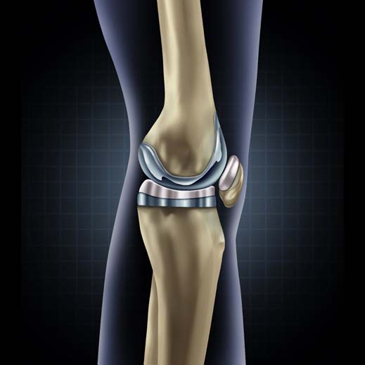 five-myths-about-knee-replacement-surgery